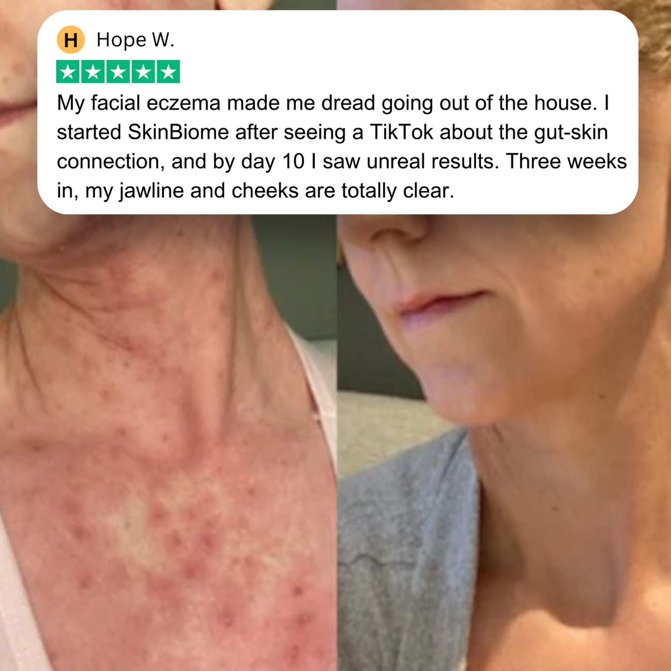 SkinBiome™ 10-in-1 Probiotic