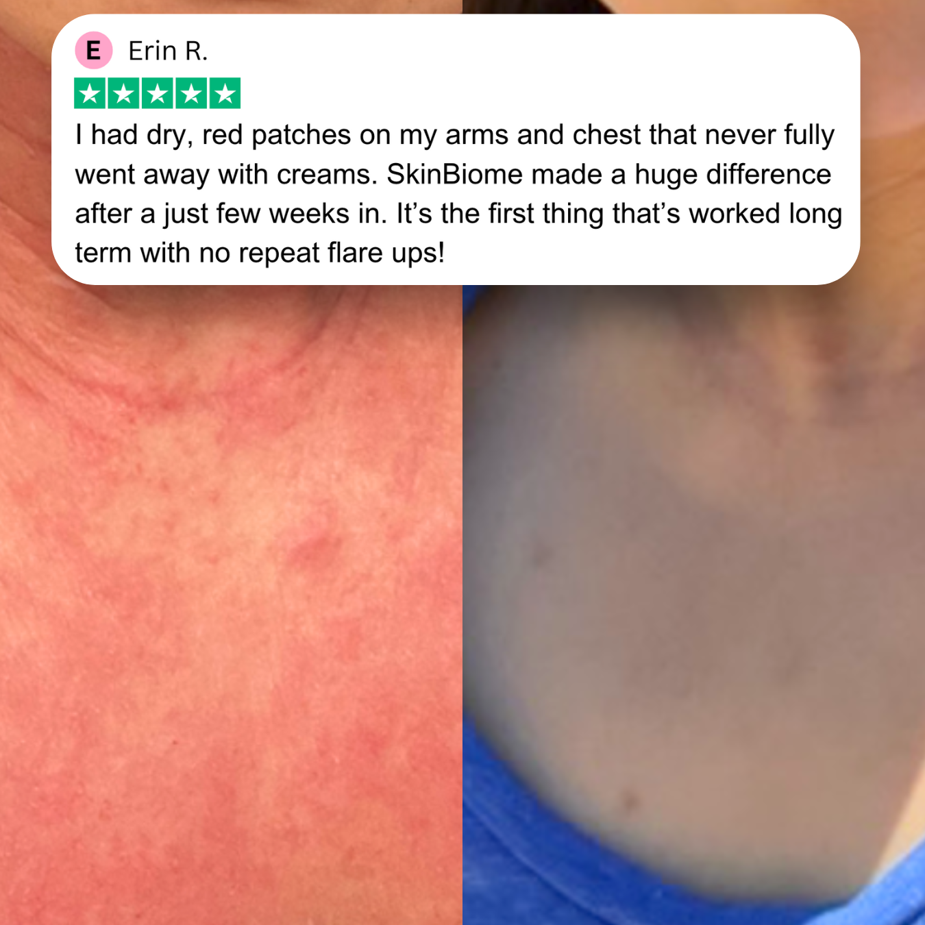 SkinBiome™ 10-in-1 Probiotic